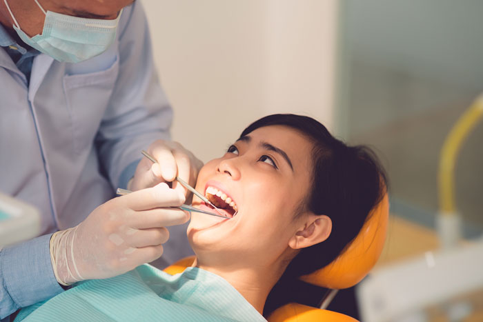 Dental Fillings