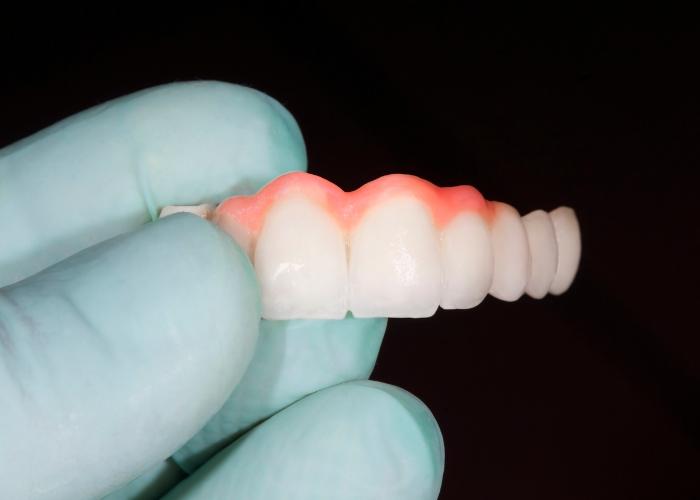 Dental Bridge Boise