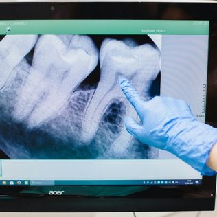 Board-Certified Oral Surgeon Boise ID providing comprehensive care