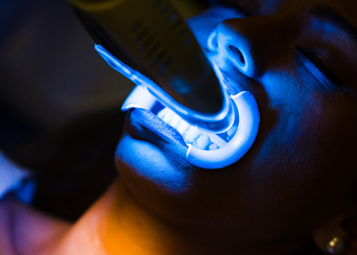 Teeth Whitening Boise